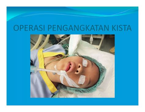 cara menghilangkan kista pada rahim 3