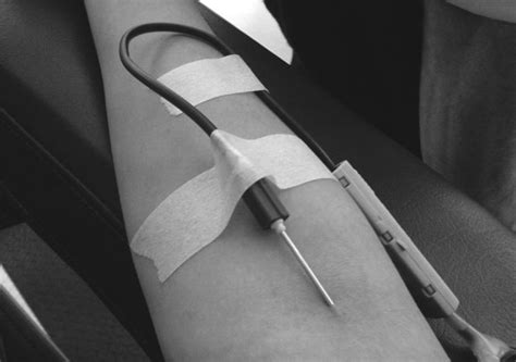 Gay Blood Ban To Be Lifted In Northern Ireland