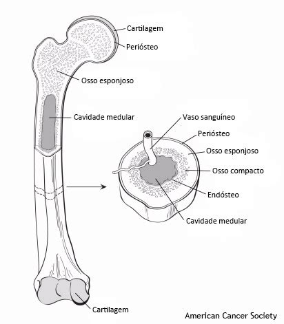 Qual É O Osso Mais Forte Do Corpo Humano - Recomeçar: Câncer > Tumores Ósseos: O Osso