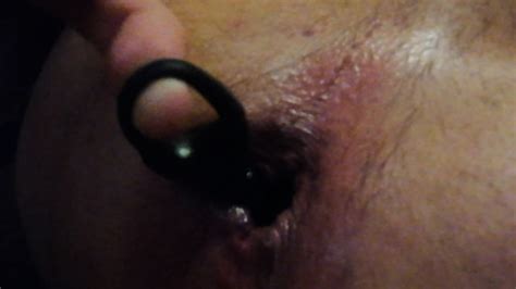 Huge Anal Plug Tore Anal Sphincter
