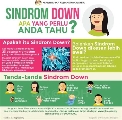 Penyakit Sindrom Down Punca Tanda And Rawatan Tips Kesihatan