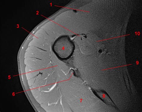 Anatomie Irm De L Paule