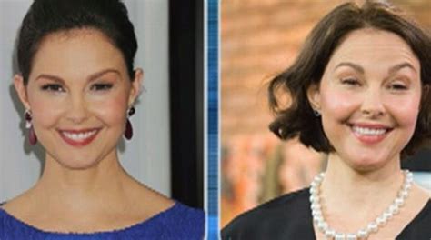 Ashley Judd before and after Plastic Surgery (2) – Celebrity plastic ...