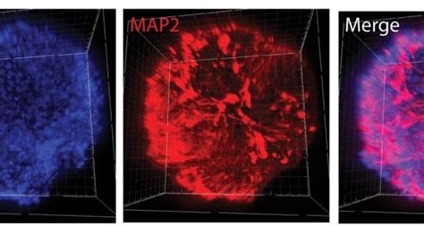 Why Do I Get Utis Understanding And Preventing Urinary Tract Infections After Sex