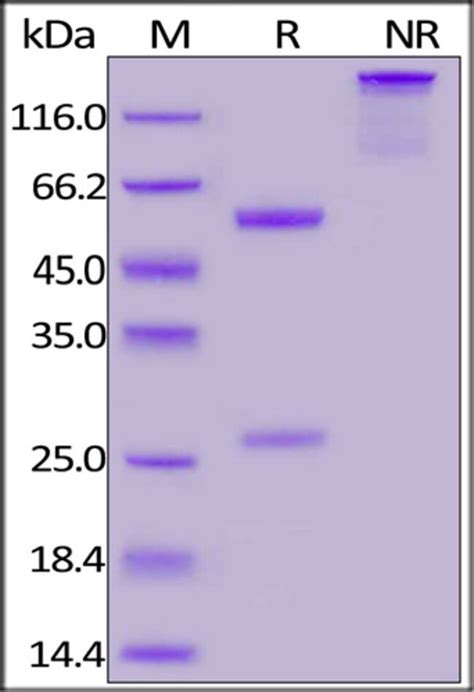 Acrobiosystems Acrobiosystems Anti Sars Cov Nucleocapsid Antibody