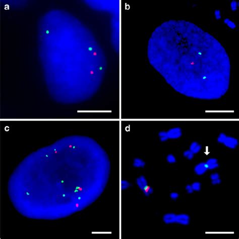 Fluorescence In Situ Hybridization Analysis Of The Egfr Gene Status