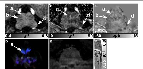 Figure From High Resolution Mr Imaging Of The Human Brainstem In Vivo