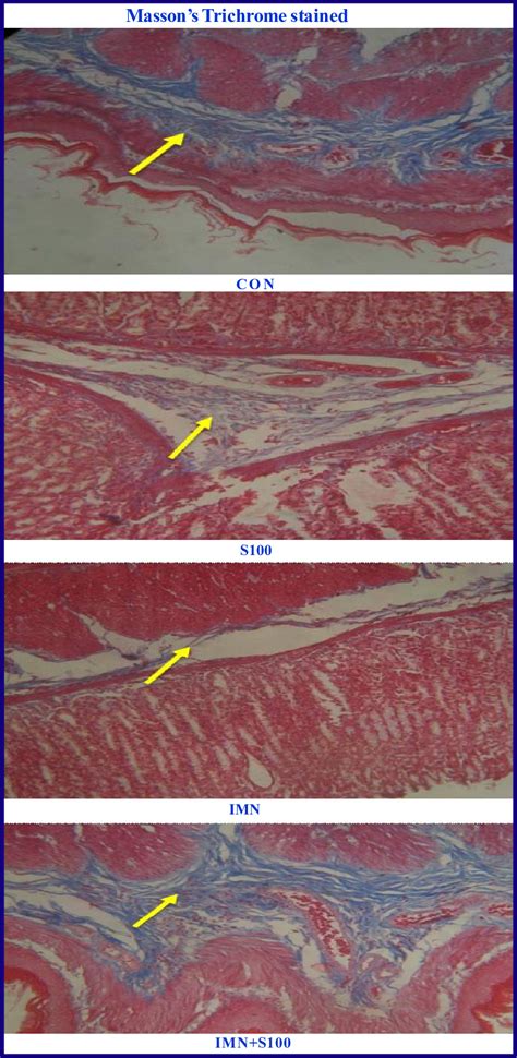 The Figure Represents The Photomicrographs Of Massons Trichrome