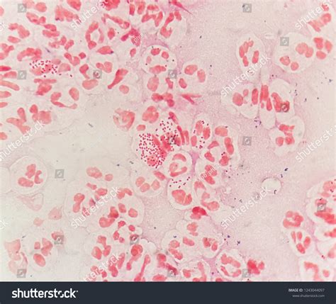 Gram Negative Diplococci Stock Photos and Pictures - 469 Images ...