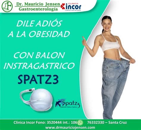 Dile Adi S A La Obesidad Con El Bal N Intragastrico Dr Mauricio