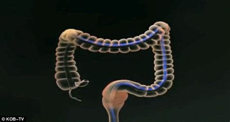 Routine Traffic Stop Results In 14 Hour Anal Cavity Search Including Three Enemas And A