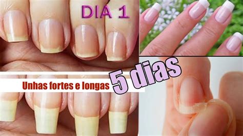 O Que Faz Crescer A Unha - 10
