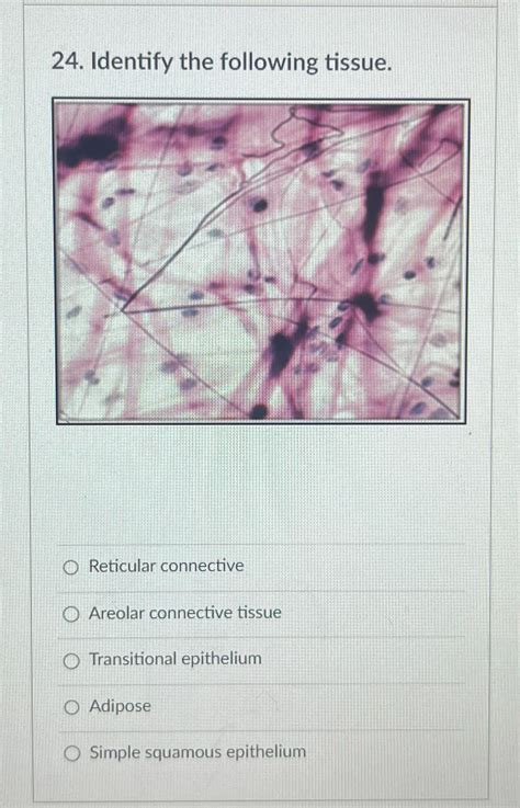 Solved Identify the following tissue.Reticular | Chegg.com