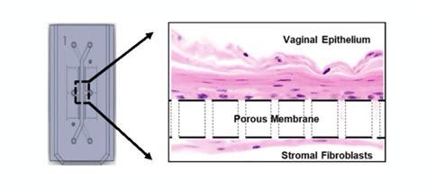 Crean Un Chip Que Simula La Vagina Para Conocer M S Sobre Las Infecciones Infobae