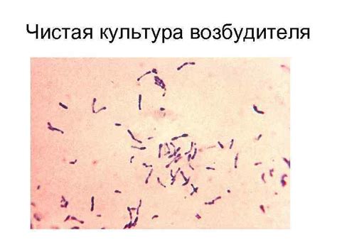 ЛЕКЦИЮ ЧИТАЕТ Заведующий Кафедрой микробиологии вирусологии и иммунологии