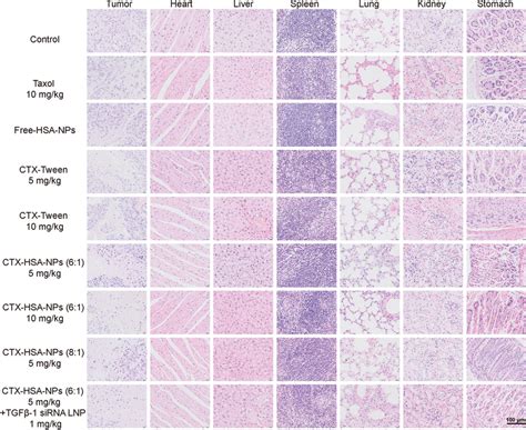 Pathological Sections Of Tumors And Organs From Nude Mice After