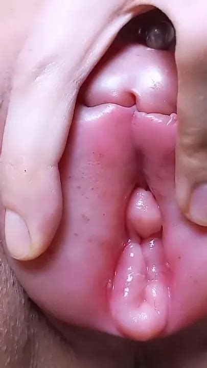 Kostenlose Extreme Pussy Pump Porno Videos Von Xhamster