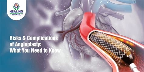 Risks And Complications Of Angioplasty What You Need To Know