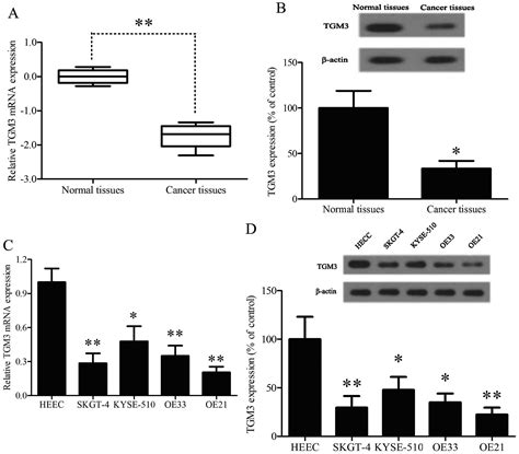 Transglutaminase 3 Protein Modulates Human Esophageal Cancer Cell