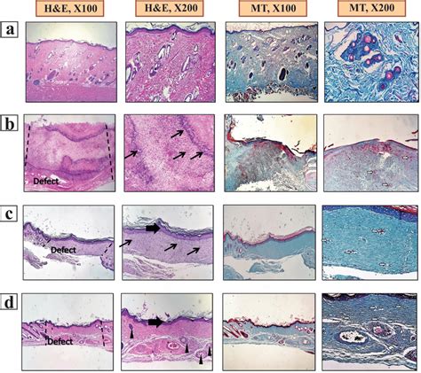 Haematoxylin And Eosin H E And Massons Trichrome Mt Stained