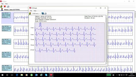 omron heartscan software  ecg primarycaresupplies