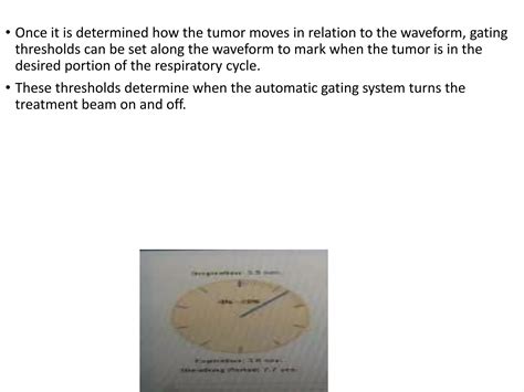 Respiration Motion Management Ppt