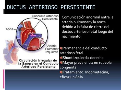 Ppt Neonato Con Cardiopatías Congenitas Cc Powerpoint Presentation