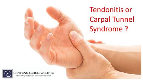 Tendonitis Vs Carpal Tunnel Identifying Differences