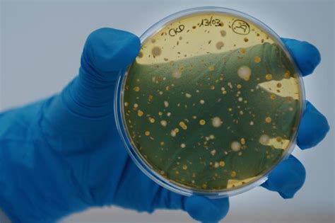 AB-BIOTICS on LinkedIn: AB-Biotics to spotlight women’s health ...