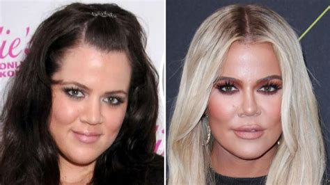 Khloe Kardashian Thanks Plastic Surgeon for Nose Job Plastic Surgery