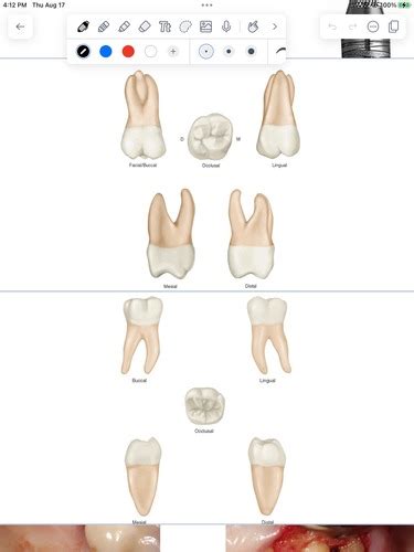 Nonsurgical Perio Exam 1 Flashcards Quizlet