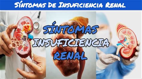 SEÑALES o SÍNTOMAS de INSUFICIENCIA RENAL YouTube