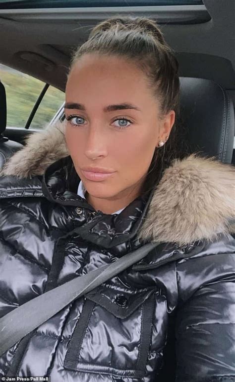 Mother Of Two 29 Left With Wonky Nipples After A Botched Boob Job In Turkey Says She Knew It