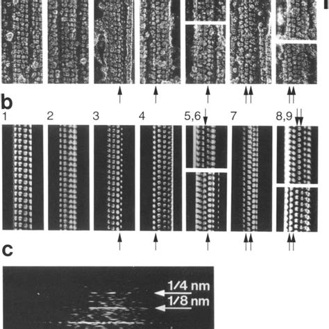 Electron Micrographs Of Quick Freeze Deep Etch Replicas Of A A