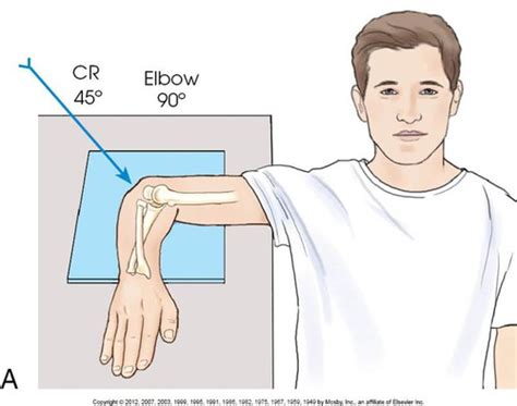 Rad 112 Procedures Lab Elbow And Humerus Flashcards Quizlet