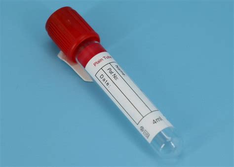 Edta Vacuum Blood Collection Tube Medical Serum Blood Test Vacuum Tubes