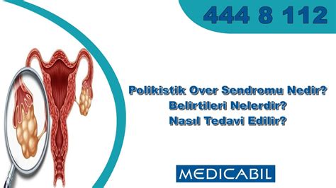 Blog Polikistik Over Sendromu Pcos Nedir Belirtileri Nelerdir