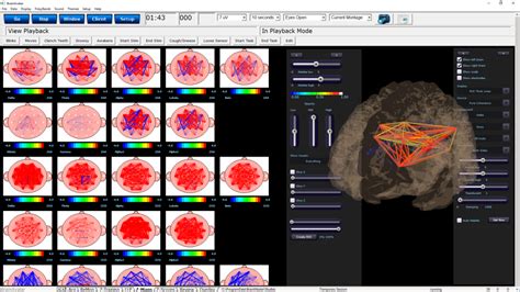 Brainavatar 40 Neurofeedback Qeeg And 3d Sloreta Brain Imaging