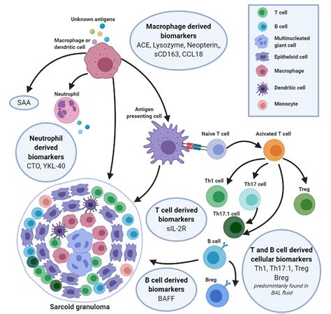 Biomarkers In The Diagnosis And Prognosis Of Sarcoidosis Current Use And Future Prospects