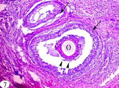 A Photomicrograph Of The Ovary Showing Atretic Ovarian Follicles →