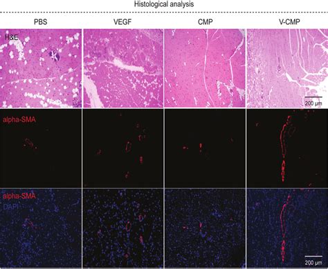 Histological And Immunostaining Analysis Of The Ischemia Tissues