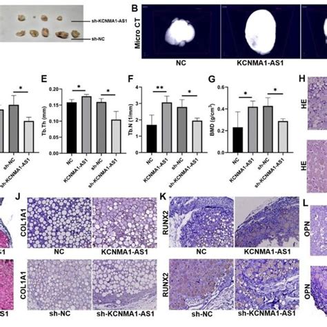 KCNMA1 AS1 Promotes In Vivo Bone Formation From HBMSCs A Xenograft