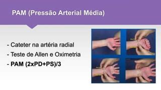 Para Que Serve A Pam Na Uti - Monitorização UTI | PPTX