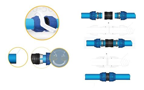 Kit Unidades Uni O De Compress O Pp P Pead Mm Pn