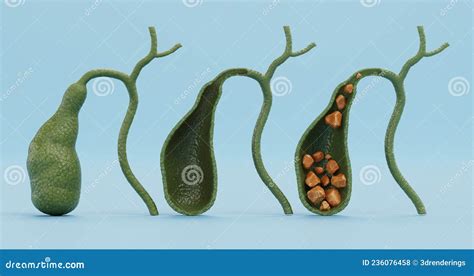 Gallbladder Cross Section Real Human Anatomy On Blue Background