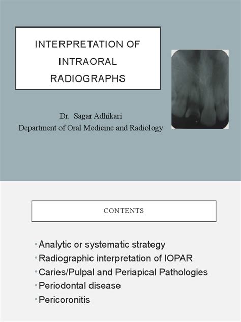 Intraoral Radiographs Interpretation | PDF | Periodontology | Health ...