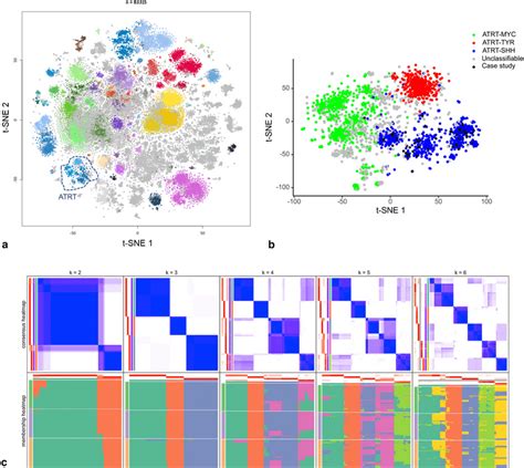 DNA Methylation Profiling Of ATRTSHH Reveals Three Distinct Molecular