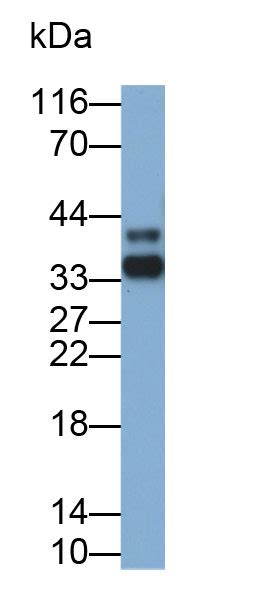 polyclonal antibody  interleukin  receptor alpha ilra