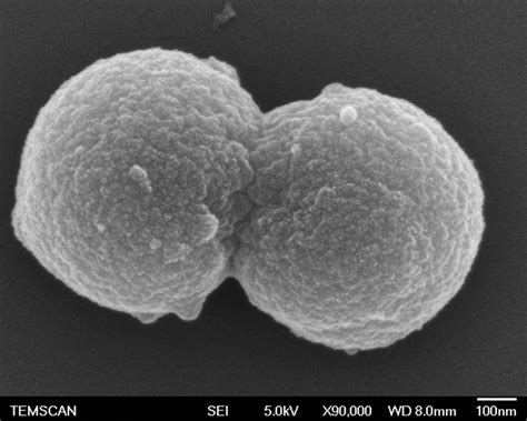 Evolution et diversité du troisième domaine du vivant : les Archaea