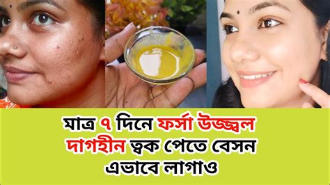 মাত্র 5 মিনিটেই দাগহীন ফর্সা উজ্জ্বল ত্বক Besan Face Pack Daily Skin